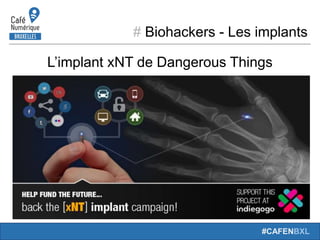 # Biohackers - Les implants
#CAFENBXL
L’implant xNT de Dangerous Things
 