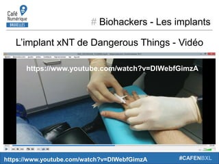 # Biohackers - Les implants
#CAFENBXL
L’implant xNT de Dangerous Things - Vidéo
https://www.youtube.com/watch?v=DlWebfGimzA
https://www.youtube.com/watch?v=DlWebfGimzA
 