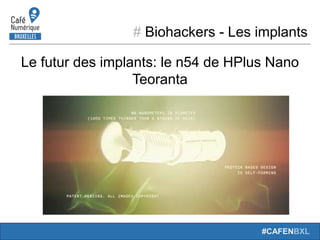 # Biohackers - Les implants
#CAFENBXL
Le futur des implants: le n54 de HPlus Nano
Teoranta
 