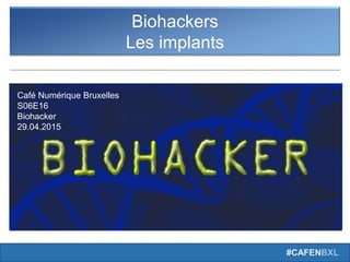 #CAFENBXL
Biohackers
Les implants
Café Numérique Bruxelles
S06E16
Biohacker
29.04.2015
 