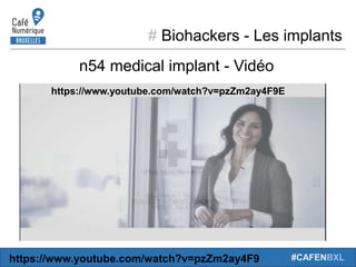 # Biohackers - Les implants
#CAFENBXL
n54 medical implant - Vidéo
https://www.youtube.com/watch?v=pzZm2ay4F9E
https://www.youtube.com/watch?v=pzZm2ay4F9
 