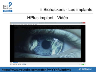 # Biohackers - Les implants
#CAFENBXL
HPlus implant - Vidéo
https://www.youtube.com/watch?v=YYHRJbpbmu
https://www.youtube.com/watch?v=YYHRJbpbmu
0
 