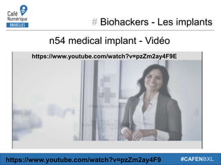 # Biohackers - Les implants
#CAFENBXL
n54 medical implant - Vidéo
https://www.youtube.com/watch?v=pzZm2ay4F9E
https://www....