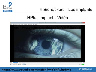 # Biohackers - Les implants
#CAFENBXL
HPlus implant - Vidéo
https://www.youtube.com/watch?v=YYHRJbpbmu
https://www.youtube...