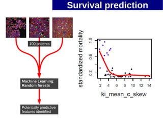 Survival prediction



    100 patients




Machine Learning:
Random forests




Potentially predictive
features identified
 