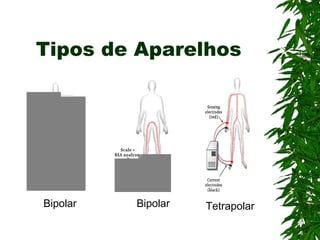 Tipos de Aparelhos Bipolar Bipolar Tetrapolar 
