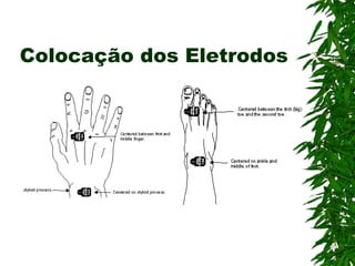 Colocação dos Eletrodos 