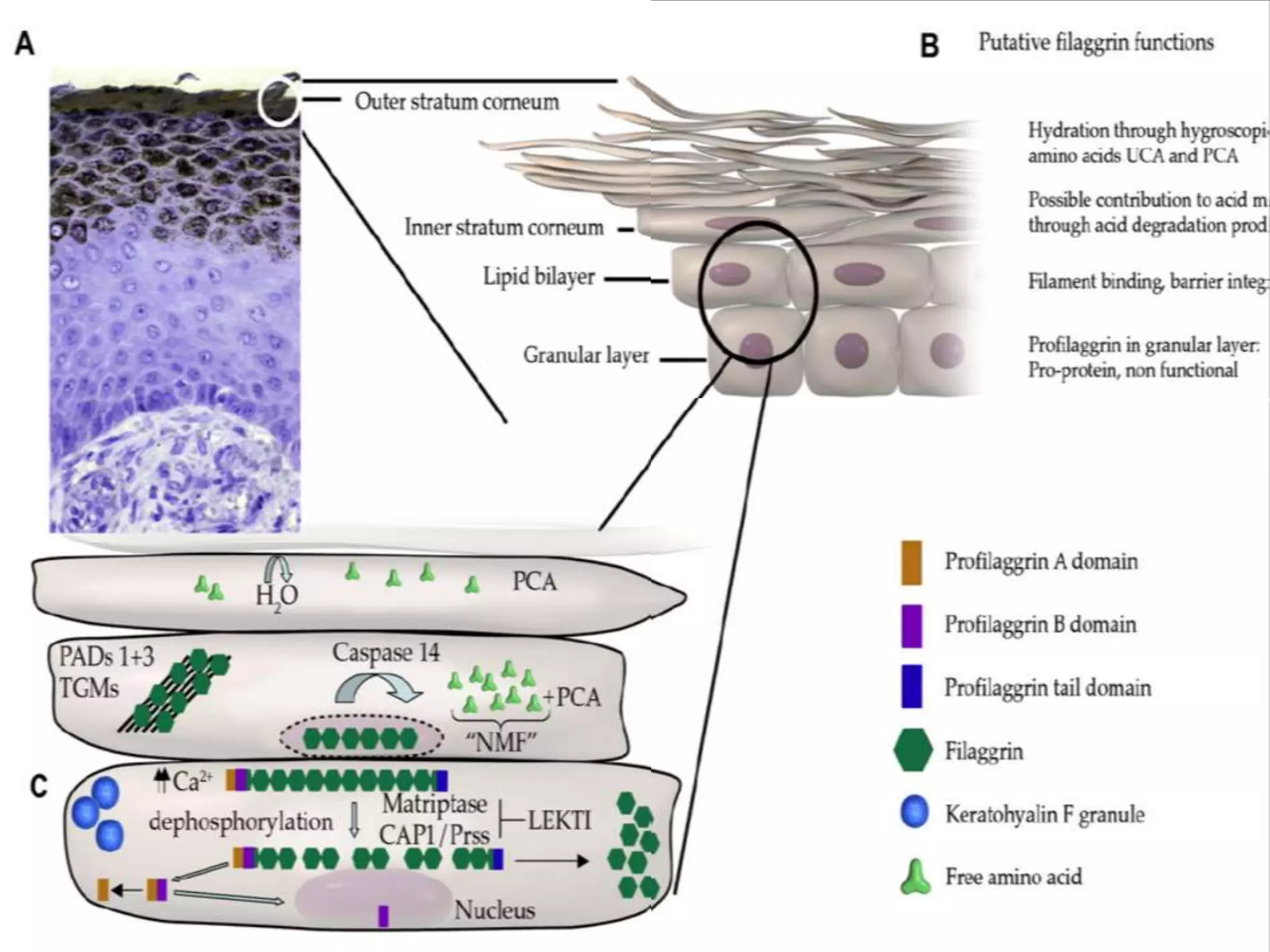 Filaggrin Gene Mutation
• Filaggrins are filament-associated proteins which
bind to keratin fibers in epithelial cells
• Normally found in large quantities in the
outermost layers of the skin
• Is essential for skin barrier function, helping to
form a protective layer at the surface of the skin
• Individuals with truncation mutation in the gene
coding for filaggrin are strongly predisposed to a
severe form of dry skin (ichthyosis vulgaris),
asthma, and eczema
 