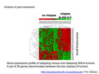 Analysis of gene expression
Gene expression profile of relapsing versus non-relapsing Wilms tumors.
A set of 39 genes discriminates between the two classes of tumors.
(http://www.biozentrum2.uni-wuerzburg.de/, Prof. Gessler)
39
 