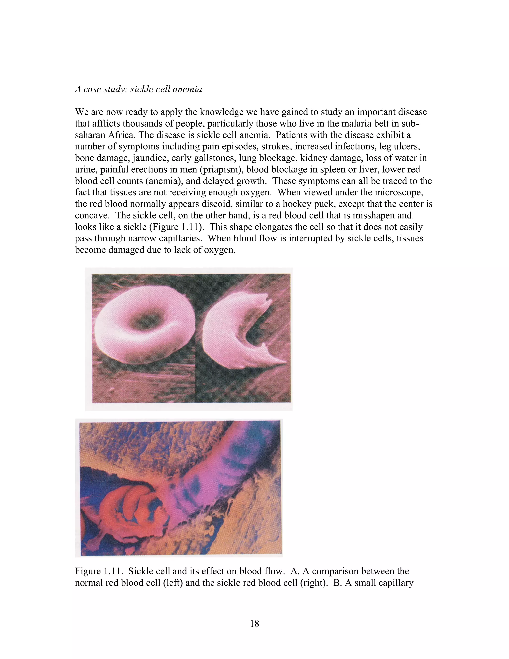 A case study: sickle cell anemia
We are now ready to apply the knowledge we have gained to study an important disease
that afflicts thousands of people, particularly those who live in the malaria belt in sub-
saharan Africa. The disease is sickle cell anemia. Patients with the disease exhibit a
number of symptoms including pain episodes, strokes, increased infections, leg ulcers,
bone damage, jaundice, early gallstones, lung blockage, kidney damage, loss of water in
urine, painful erections in men (priapism), blood blockage in spleen or liver, lower red
blood cell counts (anemia), and delayed growth. These symptoms can all be traced to the
fact that tissues are not receiving enough oxygen. When viewed under the microscope,
the red blood normally appears discoid, similar to a hockey puck, except that the center is
concave. The sickle cell, on the other hand, is a red blood cell that is misshapen and
looks like a sickle (Figure 1.11). This shape elongates the cell so that it does not easily
pass through narrow capillaries. When blood flow is interrupted by sickle cells, tissues
become damaged due to lack of oxygen.
Figure 1.11. Sickle cell and its effect on blood flow. A. A comparison between the
normal red blood cell (left) and the sickle red blood cell (right). B. A small capillary
18
 