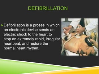 DEFIBRILLATION 
Defibrillation is a proses in which 
an electronic devise sends an 
electric shock to the heart to 
stop an extremely rapid, irregular 
heartbeat, and restore the 
normal heart rhythm. 
 