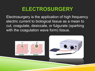 ELECTROSURGERY 
Electrosurgery is the application of high frequency 
electric current to biological tissue as a mean to 
cut, coagulate, desiccate, or fulgurate (sparking 
with the coagulation wave form) tissue. 
 