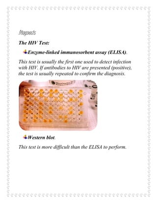 Diagnosis
The HIV Test:
Enzyme-linked immunosorbent assay (ELISA).
This test is usually the first one used to detect infection
with HIV. If antibodies to HIV are presented (positive),
the test is usually repeated to confirm the diagnosis.
Western blot.
This test is more difficult than the ELISA to perform.
 