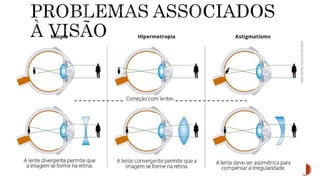 Sistema Nervoso e Sensorial.pptx