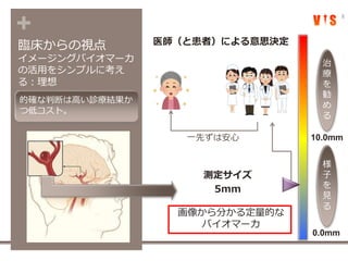 +
臨床からの視点
イメージングバイオマーカ
の活用をシンプルに考え
る：理想
8
医師（と患者）による意思決定
画像から分かる定量的な
バイオマーカ
測定サイズ
5mm
10.0mm
0.0mm
様
子
を
見
る
治
療
を
勧
め
る
一先ずは安心
的確な判断は高い診療結果か
つ低コスト。
 