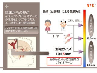 +
臨床からの視点
イメージングバイオマーカ
の活用をシンプルに考え
る：現実にあり得る課題
9
医師（と患者）による意思決定
画像から分かる定量的な
バイオマーカ
測定サイズ
10±5mm
10.0mm
0.0mm
様
子
を
見
る
治
療
を
勧
め
る
！？
これは複雑…
バラツキのある判断は低い診
療結果かつ高コスト。
 