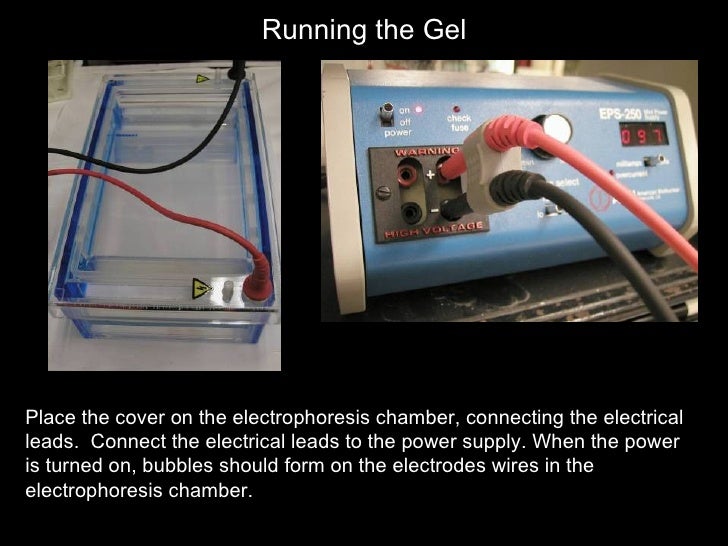 Biol2 Lecture 2 Dna Isolation And Agarose Gel 