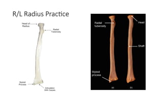Comprehensive Appendicular Skeleton Model and Bone Identification Guide ...