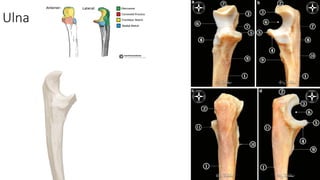 Comprehensive Appendicular Skeleton Model and Bone Identification Guide ...