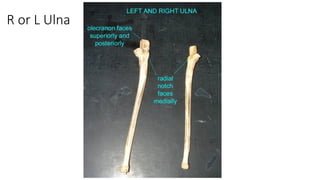 Comprehensive Appendicular Skeleton Model and Bone Identification Guide ...