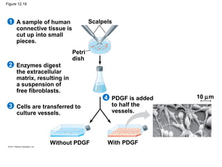 Figure 12.18

Scalpels

1 A sample of human
connective tissue is
cut up into small
pieces.

2 Enzymes digest
the extracellular
matrix, resulting in
a suspension of
free fibroblasts.

Petri
dish

3 Cells are transferred to
culture vessels.

Without PDGF

4 PDGF is added
to half the
vessels.

With PDGF

10 µm

 