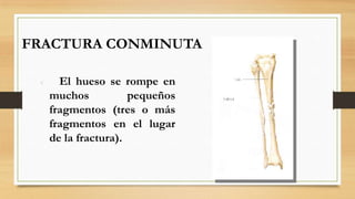 FRACTURA CONMINUTA
 El hueso se rompe en
muchos pequeños
fragmentos (tres o más
fragmentos en el lugar
de la fractura).
 