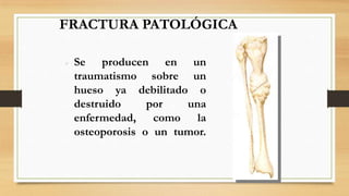 FRACTURA PATOLÓGICA
 Se producen en un
traumatismo sobre un
hueso ya debilitado o
destruido por una
enfermedad, como la
osteoporosis o un tumor.
 
