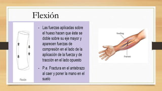 Flexión
 