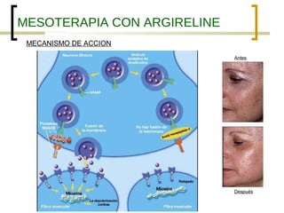 MESOTERAPIA CON ARGIRELINE
 MECANISMO DE ACCION
                             Antes




                             Después
 