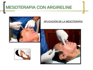 MESOTERAPIA CON ARGIRELINE


              APLICACIÓN DE LA MESOTERAPIA
 