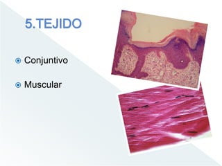  Conjuntivo
 Muscular
 