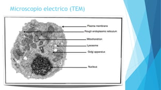 Microscopio electrico (TEM)
 