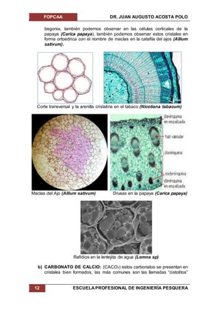 FOPCAA DR. JUAN AUGUSTO ACOSTA POLO
12 ESCUELA PROFESIONAL DE INGENIERÍA PESQUERA
begonia, también podemos observar en las células corticales de la
papaya (Carica papaya), también podemos observar estos cristales en
forma ortoedrica con el nombre de maclas en la catafila del ajos (Allium
sativum).
Corte transversal y la arenilla cristalina en el tabaco (Nicotiana tabacum)
Maclas del Ajo (Allium sativum) Drusas en la papaya (Carica papaya)
Rafidios en la lentejita de agua (Lemna sp)
b) CARBONATO DE CALCIO: (CACO3) estos carbonatos se presentan en
cristales bien formados, las más comunes son las llamadas “cistolitos”
 