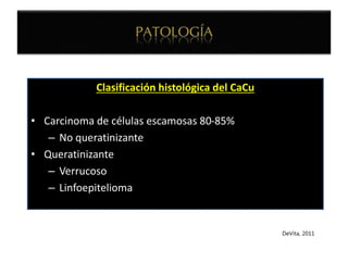 Clasificación histológica del CaCu
• Carcinoma de células escamosas 80-85%
– No queratinizante
• Queratinizante
– Verrucoso
– Linfoepitelioma
DeVita, 2011
 