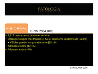RHNM 2004 2006
DISTRITO FEDERAL
• 7,817 casos nuevos de cáncer cervical
• El tipo histológico más frecuente fue el carcinoma epidermoide (66.6%)
• Células grandes no queratinizante (35.1%)
• Adenocarcinoma (12.1%)
• Adenoescamoso (4%)
RHNM 2004-2006
 