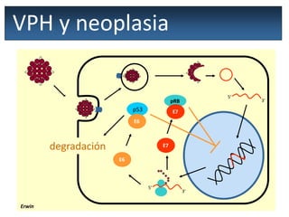 VPH y neoplasia
Erwin
5’
3’
5’
3’
E6
E7
p53
E6
pRB
E7
degradación
 