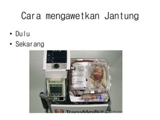 Cara mengawetkan Jantung
• Dulu
• Sekarang
 