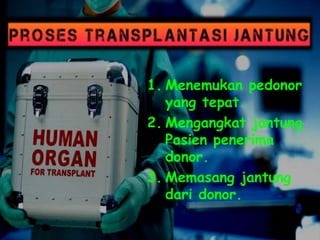 1. Menemukan pedonor
yang tepat.
2. Mengangkat jantung
Pasien penerima
donor.
3. Memasang jantung
dari donor.
 