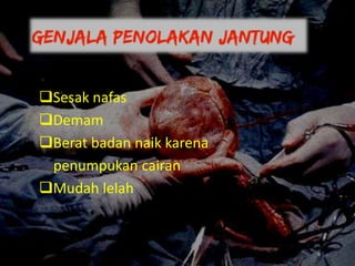 Sesak nafas
Demam
Berat badan naik karena
penumpukan cairan
Mudah lelah
 