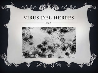 VIRUS DEL HERPES
 