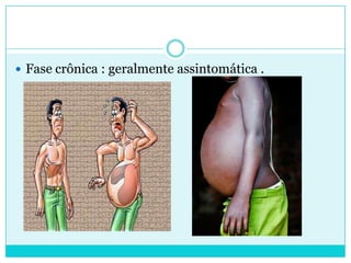  Fase crônica : geralmente assintomática .
 