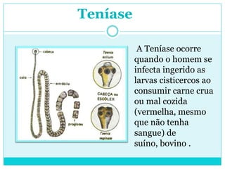 Teníase
A Teníase ocorre
quando o homem se
infecta ingerido as
larvas cisticercos ao
consumir carne crua
ou mal cozida
(vermelha, mesmo
que não tenha
sangue) de
suíno, bovino .
 