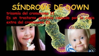trisomía del cromosoma 21
Es un trastorno genético causado por la copia
extra del cromosoma 21
 