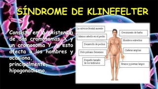 Consiste en la existencia
de dos cromosomas X y
un cromosoma Y, y esto
afecta a los hombres y
ocasiona,
principalmente,
hipogonadismo.
 