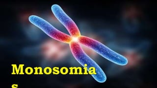 Monosomia
 