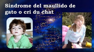 Síndrome del maullido de
gato o cri du chat
 