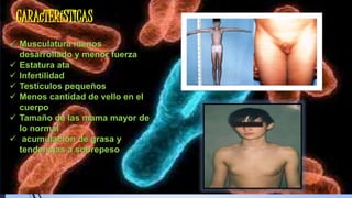 CARAcTERíSTICAS
 Musculatura menos
desarrollado y menor fuerza
 Estatura ata
 Infertilidad
 Testículos pequeños
 Menos cantidad de vello en el
cuerpo
 Tamaño de las mama mayor de
lo normal
 acumulación de grasa y
tendencias a sobrepeso
 
