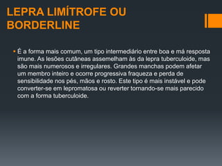 LEPRA LIMÍTROFE OU
BORDERLINE
 É a forma mais comum, um tipo intermediário entre boa e má resposta
imune. As lesões cutâneas assemelham às da lepra tuberculoide, mas
são mais numerosos e irregulares. Grandes manchas podem afetar
um membro inteiro e ocorre progressiva fraqueza e perda de
sensibilidade nos pés, mãos e rosto. Este tipo é mais instável e pode
converter-se em lepromatosa ou reverter tornando-se mais parecido
com a forma tuberculoide.
 