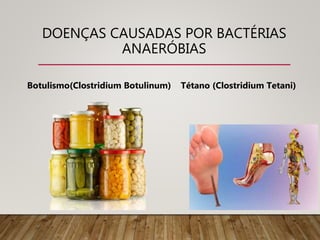 DOENÇAS CAUSADAS POR BACTÉRIAS
ANAERÓBIAS
Botulismo(Clostridium Botulinum) Tétano (Clostridium Tetani)
 