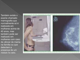 Também existe o
exame chamado
mamografia que
normalmente só é
realizada em
mulheres acima de
40 anos, mas
também pode ser
realizado em
mulheres com caso
de câncer de mama
na família ou que
detectam a
presença de um
nódulo no seio.
 